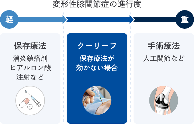 変形性膝関節症の進行度と治療選択肢